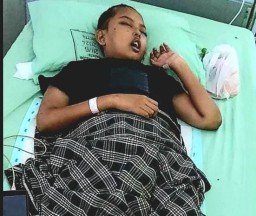 Dua Tahun Idap Tumor ABK Yatim Piatu Belum Pernah Mendapatkan Tindakan Medis