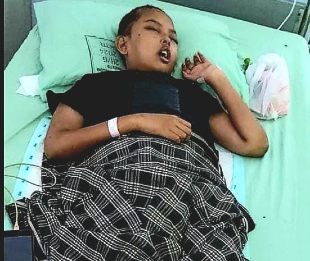 Kondisi Okta yang kian hari kian melemah karena tumor yang dideritanya belum dilakukan operasi (foto : bagus/redaksi_beritaformat.com)